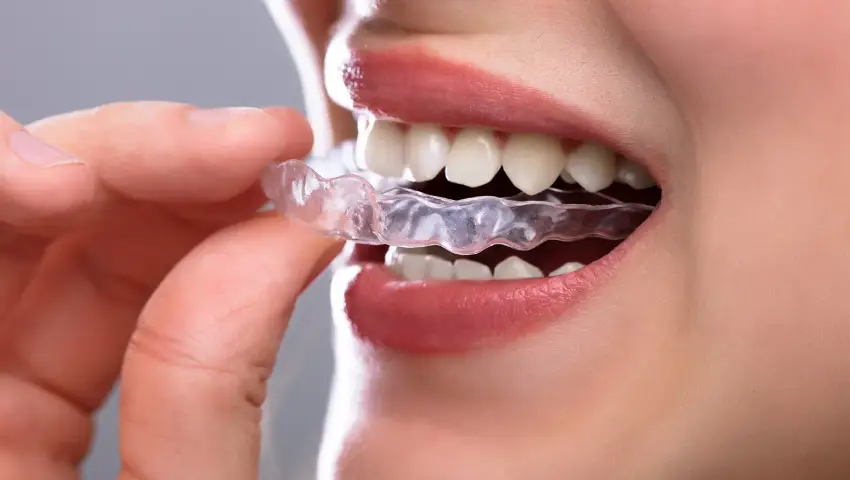 Smiling adult showing clear invisible aligners for teeth correction, highlighting top 7 reasons